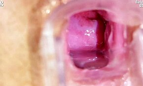 Médico velho tarado examina buceta da Jane com espéculo no hospital