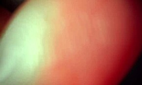 Tenåringer for VIP Jeg måtte hjem fordi mine stedforeldre ikke vet at jeg ikke er jomfru lenger