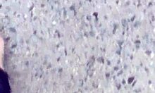 Dirty Calloused Soles, What Do You Think?