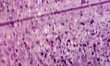 Dirty Calloused Soles, What Do You Think?