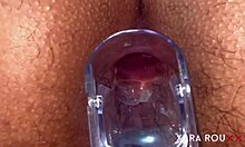 חזון אנאל ספקולום