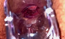 ANAL VISION SPECULUM