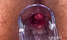 ANAL VISION SPECULUM