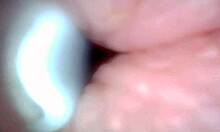 Endoscope Captures POV Cumshot And Cum Swapping In Hospital