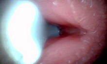 Endoscope Captures POV Cumshot And Cum Swapping In Hospital