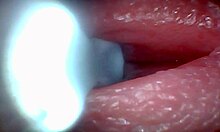 Endoscope Captures POV Cumshot And Cum Swapping In Hospital