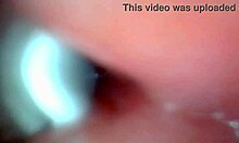 Endoscope Captures POV Cumshot And Cum Swapping In Hospital