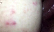 Dicknastytheillest Looks Like He Is On One Nothing But Skin Cock And Bones