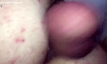 Dicknastytheillest Looks Like He Is On One Nothing But Skin Cock And Bones