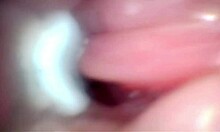 semen floods cervix in wide-stretched gaping pussy endoscope close-up