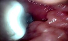 semen floods cervix in wide-stretched gaping pussy endoscope close-up