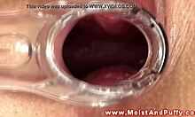 puffy peach teen spreads wide with speculum