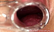 puffy peach teen spreads wide with speculum